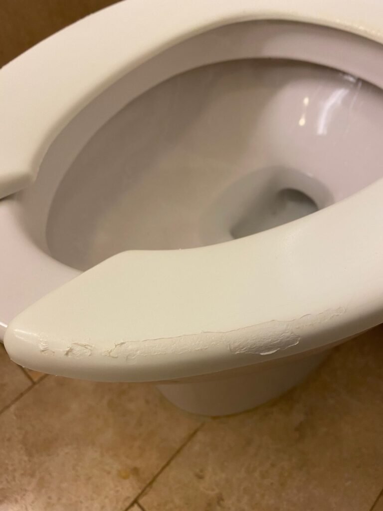 Toilet Seat Peeling